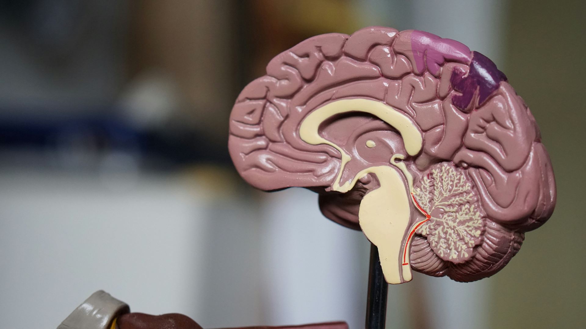 Brain statue